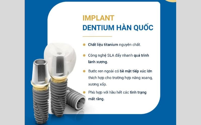 Đặc điểm nổi bật của Implant Dentium Hàn Quốc