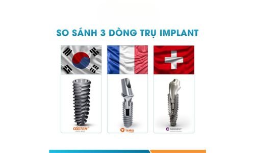 So Sánh Giá Implant Osstem và Các Thương Hiệu Khác: Sự Lựa Chọn Tối Ưu