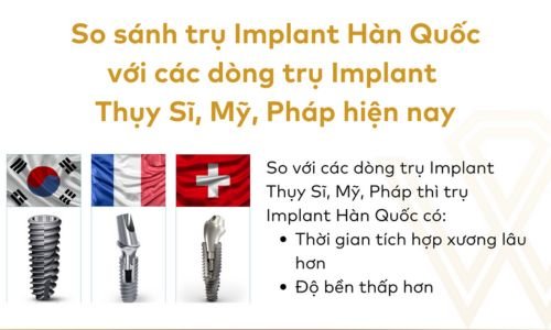 So Sánh Implant Hàn Quốc Với Các Loại Khác: Đâu Là Lựa Chọn Tốt Nhất?