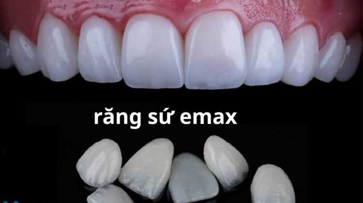 răng sứ emax